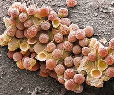 Attēlu rezultāti vaicājumam “Diachea leucopodia spores”