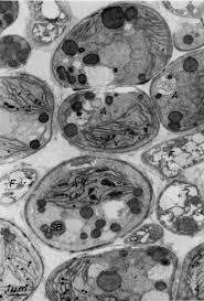 Attēlu rezultāti vaicājumam “Gloeocapsa rupestris”