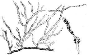 Attēlu rezultāti vaicājumam “Bryum pallens sporophyte”