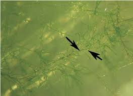 Attēlu rezultāti vaicājumam “Dicranum scoparium sporophyte”