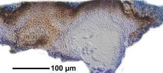 Attēlu rezultāti vaicājumam “Verrucaria hydrela”