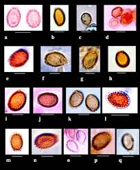 Attēlu rezultāti vaicājumam “Ganoderma applanatum”
