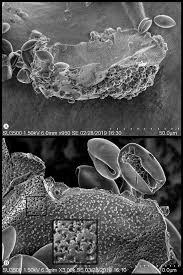 Attēlu rezultāti vaicājumam “Licea pusilla spores”