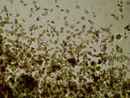 Attēlu rezultāti vaicājumam “Lecanora conizaeoides”