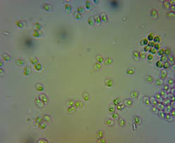 Attēlu rezultāti vaicājumam “Schizopora paradoxa”