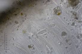 Attēlu rezultāti vaicājumam “Petractis sp.”