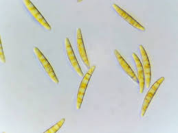 Attēlu rezultāti vaicājumam “Hyalorbilia inflatula”