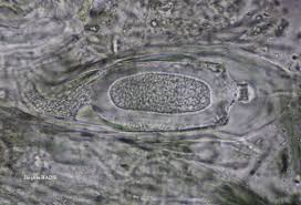 Attēlu rezultāti vaicājumam “Mycoblastus sanguinarius”