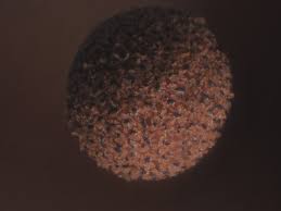 Attēlu rezultāti vaicājumam “Cribraria piriformis macro”