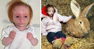 Image result for Nanismo Primordial