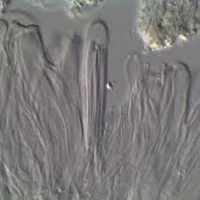 Attēlu rezultāti vaicājumam “Bacidia rubella”