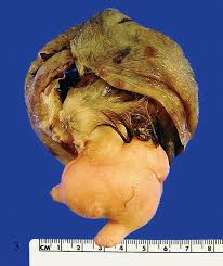 Attēlu rezultāti vaicājumam “Tetratoma ancora”