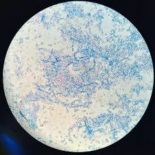 Attēlu rezultāti vaicājumam “Trichia contorta young”
