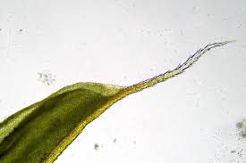 Attēlu rezultāti vaicājumam “Heterotrichia pomiformis (syn. Arcyria pomiformis) macro”