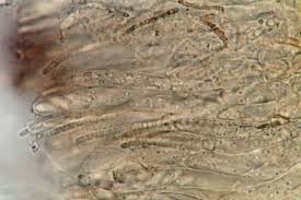 Attēlu rezultāti vaicājumam “Hymenoscyphus imberbis”