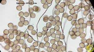 Attēlu rezultāti vaicājumam “Comatricha ellae spores”