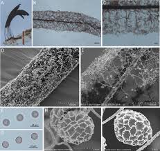 Attēlu rezultāti vaicājumam “Stemonitis flavogenita spores”