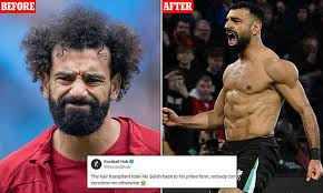 Image result for Liverpool Transplant FC