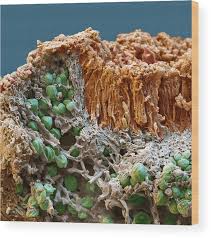 Attēlu rezultāti vaicājumam “Caloplaca saxicola”