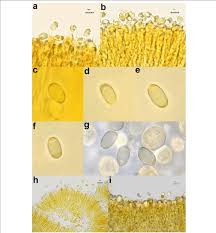 Attēlu rezultāti vaicājumam “Trichia longipalpis spores”