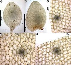 Attēlu rezultāti vaicājumam “Dicranella staphylina cells”