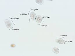 Attēlu rezultāti vaicājumam “Milesina murariae”