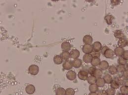 Attēlu rezultāti vaicājumam “Diderma effusum”