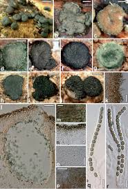 Attēlu rezultāti vaicājumam “Heterotrichia oerstedii (syn. Arcyria oerstedii) spores”