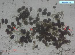 Attēlu rezultāti vaicājumam “Badhamiopsis scripta spores”