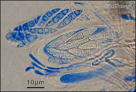 Attēlu rezultāti vaicājumam “Bilimbia tetramera”