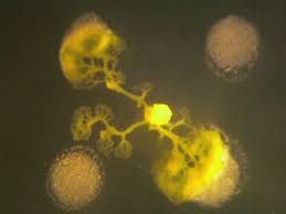 Attēlu rezultāti vaicājumam “Physarum flavicomum stalked”