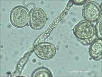 Attēlu rezultāti vaicājumam “Perichaena corticalis”