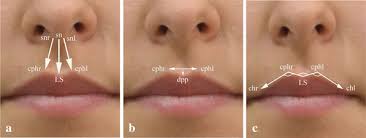 Image result for Co de Crista Chins