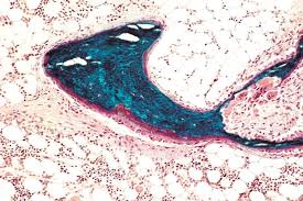 Image result for Peak Performance Ckd, Horley