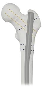 「 X t B   N X」の画像検索結果