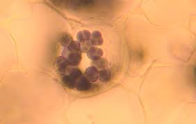 Attēlu rezultāti vaicājumam “Conocephalum salebrosum sporophyte”