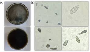 Attēlu rezultāti vaicājumam “Trichia erecta spores”