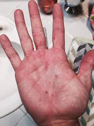 Image result for pheega