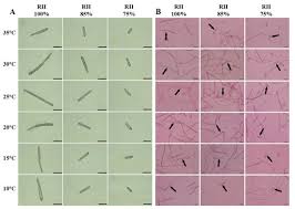 Attēlu rezultāti vaicājumam “Badhamiopsis macrospora spores”