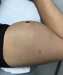 Image result for SYNTHOL