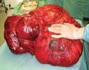 Cancer - The Free Information Society