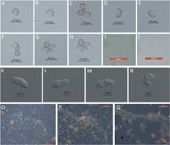 Attēlu rezultāti vaicājumam “Stemonitis fusca spores”