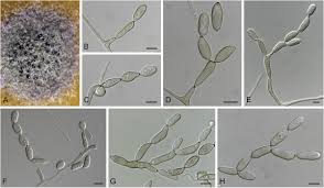 Attēlu rezultāti vaicājumam “Mycosphaerella millegrana”