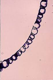 Attēlu rezultāti vaicājumam “Sphagnum centrale sporophyte”