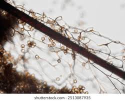 Attēlu rezultāti vaicājumam “Stemonitis flavogenita spores”