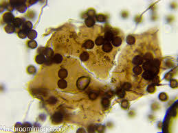 Attēlu rezultāti vaicājumam “Didymium xanthopus spores”