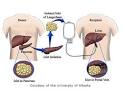 Islet-Cell-<b>Transplantation</b>-