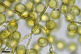 Attēlu rezultāti vaicājumam “Perichaena corticalis macro”
