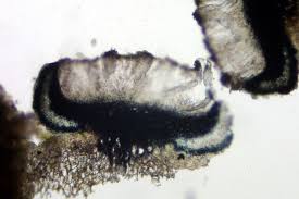 Attēlu rezultāti vaicājumam “Megalaria grossa”