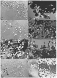 Attēlu rezultāti vaicājumam “Didymium squamulosum stalked”